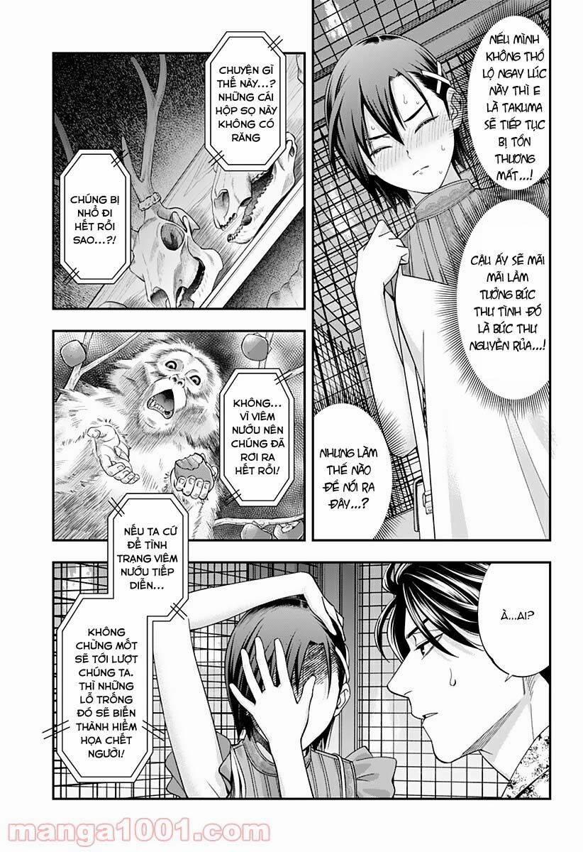 Excuse Me Dentist, It's Touching Me! 30 trang 7