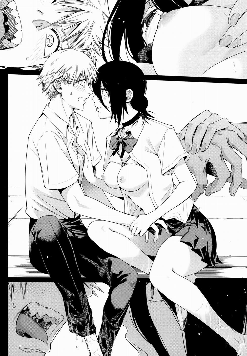 Lưỡi cưa bao quy đầu 2 [Không chữ] trang 4