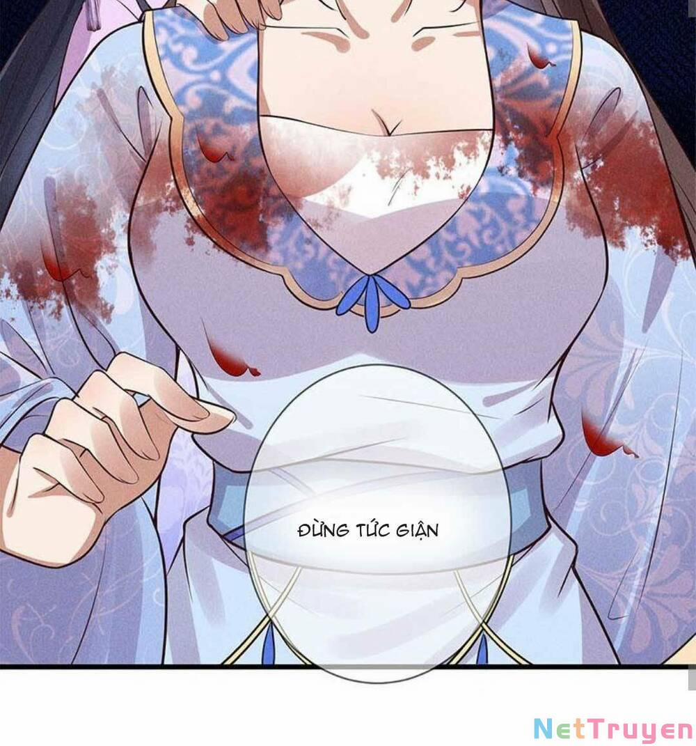 Tái Sinh Trở Lại : Ta Trở Thành Độc Y Thái Tử Phi 12 trang 26