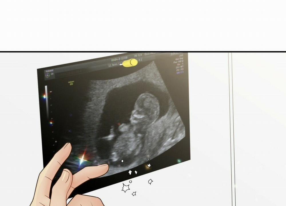 Thời gian giữa Sói và Chó 63 trang 149