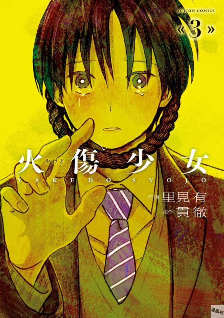 Yakedo Shoujo 15 trang 1