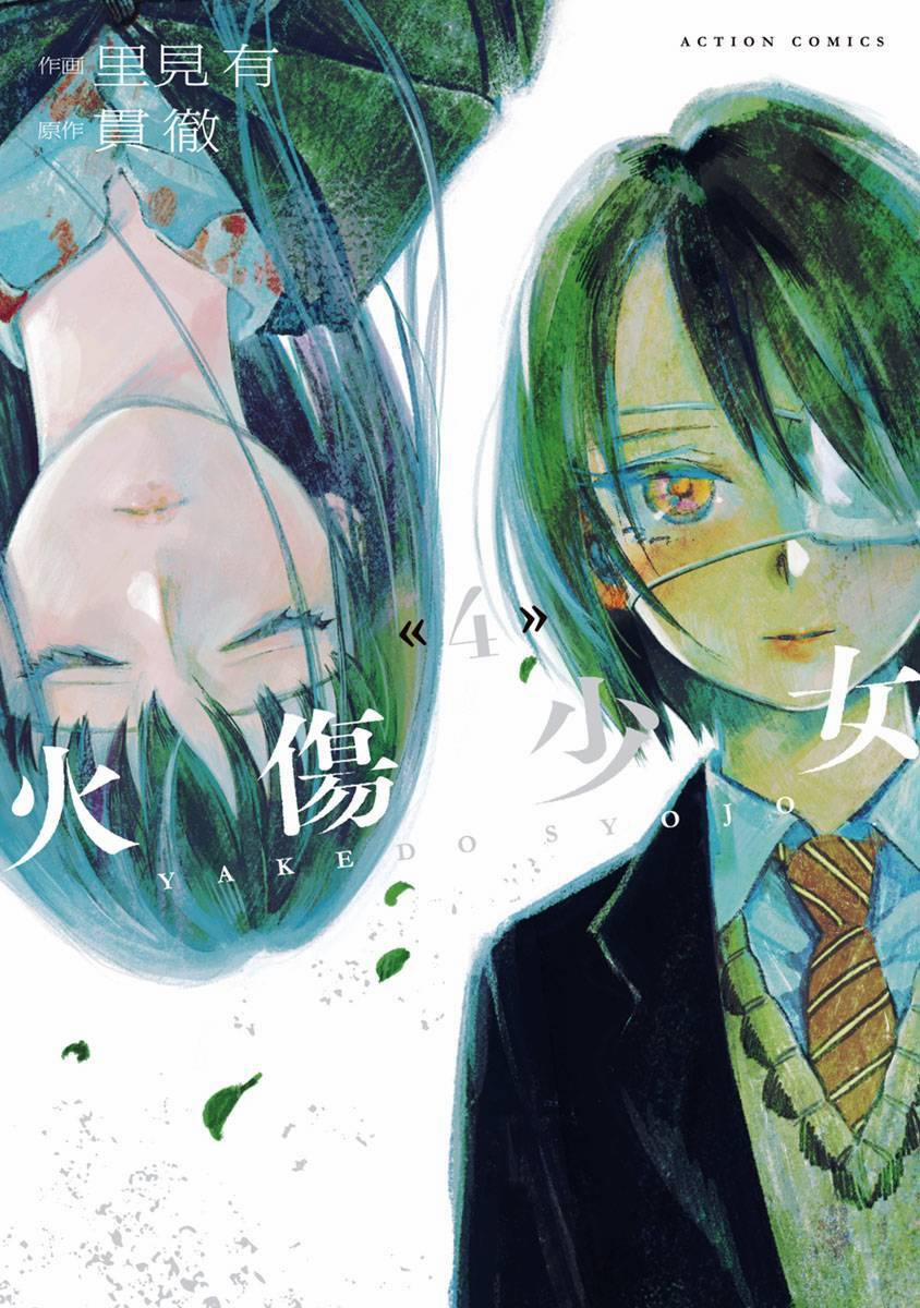 Yakedo Shoujo 21 trang 1